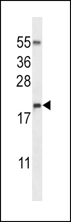 WB - RNASE3 Antibody (C-term) AP13557b