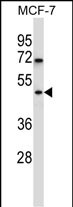 WB - WDR88 Antibody (C-term) AP13560b