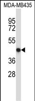 NFE2 Antibody (C-term) (Cat. #AP13561b) western blot analysis in MDA-MB435 cell line lysates (35ug/lane).This demonstrates the NFE2 antibody detected the NFE2 protein (arrow).