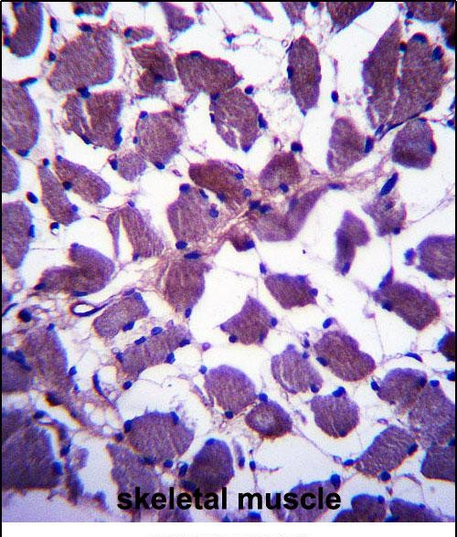 IHC-P - HSPA12B Antibody (N-term) AP13579a