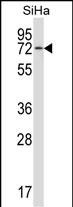 WB - HSPA12B Antibody (N-term) AP13579a
