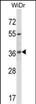 WB - RIBC2 Antibody (N-term) AP13580A