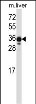 WB - LIMS2 Antibody (C-term) AP13597b