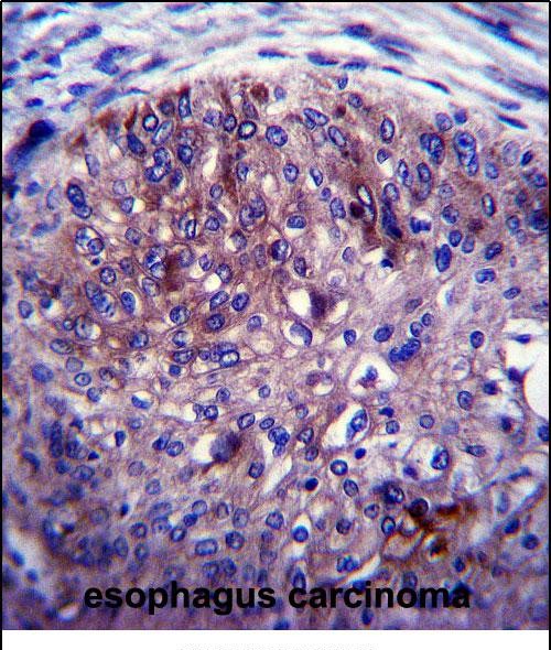 IHC-P - ADAL Antibody (C-term) AP13621b