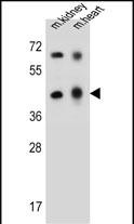 WB - ADAL Antibody (C-term) AP13621b