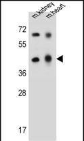 ADAL Antibody (C-term) (Cat. #AP13621b) western blot analysis in mouse kidney,heart tissue lysates (35ug/lane).This demonstrates the ADAL antibody detected the ADAL protein (arrow).