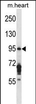WB - EXOC6B Antibody (C-term) AP13655B