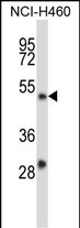 WB - YY2 Antibody (C-term) AP13666b
