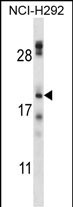 WB - TMEM17 Antibody (N-term) AP13686A