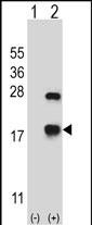 Western blot analysis of CRYAB (arrow) using rabbit polyclonal CRYAB Antibody (Center) (Cat. #AP13697c). 293 cell lysates (2 ug/lane) either nontransfected (Lane 1) or transiently transfected (Lane 2) with the CRYAB gene.
