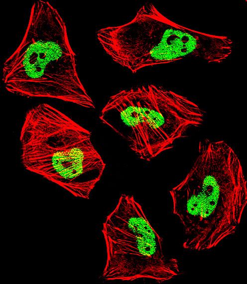 Fluorescent confocal image of Hela cell stained with TARDBP Antibody (N-term)(Cat#AP13763a).Hela cells were fixed with 4% PFA (20 min), permeabilized with Triton X-100 (0.1%, 10 min), then incubated with TARDBP primary antibody (1:25, 1 h at 37?). For secondary antibody, Alexa Fluor� 488 conjugated donkey anti-rabbit antibody (green) was used (1:400, 50 min at 37?).Cytoplasmic actin was counterstained with Alexa Fluor� 555 (red) conjugated Phalloidin (7units/ml, 1 h at 37?). Nuclei were counterstained with DAPI (blue) (10 �g/ml, 10 min).TARDBP immunoreactivity is localized to nucleus significantly and Cytoplasm weakly.