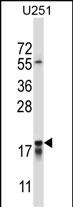 CTAG2 Antibody (Center) (Cat. #AP13767c) western blot analysis in U251 cell line lysates (35ug/lane).This demonstrates the CTAG2 antibody detected the CTAG2 protein (arrow).