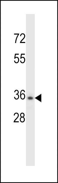 CELA3B Antibody (N-term) (Cat. #AP13770a) western blot analysis in NCI-H460 cell line lysates (35ug/lane).This demonstrates the CELA3B antibody detected the CELA3B protein (arrow).