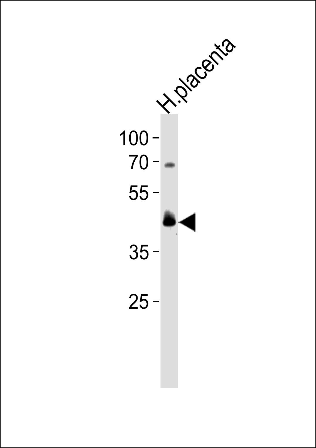 PPARD Antibody (C-term) (Cat. #AP13778b) western blot analysis in human placenta tissue lysates (35ug/lane).This demonstrates the PPARD antibody detected the PPARD protein (arrow).