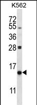 WB - PIK3IP1 Antibody (C-term) AP13792b