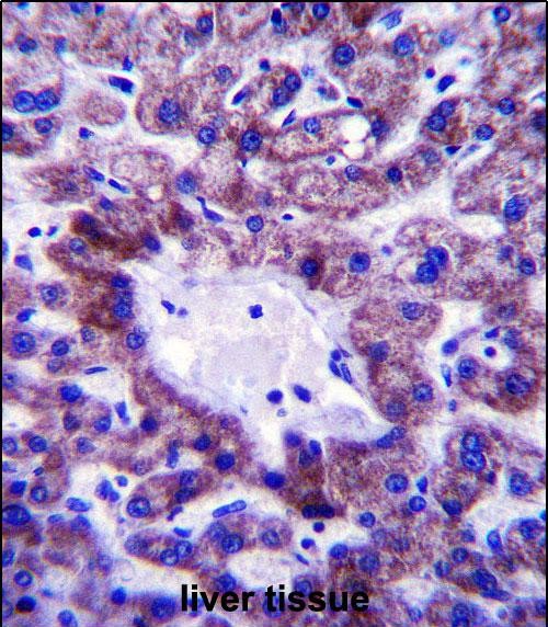 IHC-P - NADK2 Antibody (Center) AP13805c