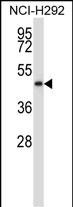 WB - NADK2 Antibody (Center) AP13805c