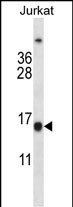 BCL2 Antibody (Center) (Cat. #AP13823c) western blot analysis in Jurkat cell line lysates (35ug/lane).This demonstrates the BCL2 antibody detected the BCL2 protein (arrow).