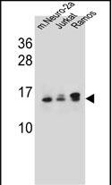 WB - UBE2E2 Antibody (N-term) AP13824a