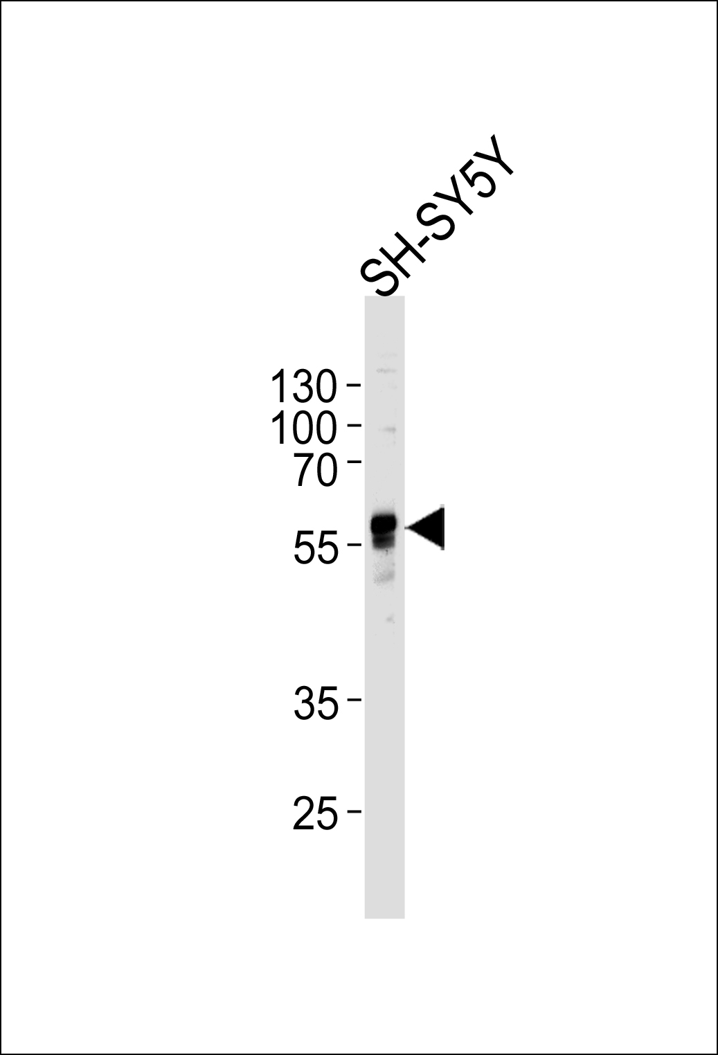 WB - ABHD3 Antibody (C-term) AP13830b