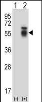 Western blot analysis of ACVR1 (arrow) using rabbit polyclonal ACVR1 Antibody (Center) (Cat. #AP13856c). 293 cell lysates (2 ug/lane) either nontransfected (Lane 1) or transiently transfected (Lane 2) with the ACVR1 gene.