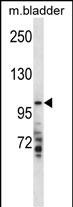 WB - TMPRSS7 Antibody (N-term) AP13872A