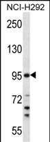 WB - TMPRSS7 Antibody (N-term) AP13872A