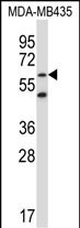WB - ZNF479 Antibody (N-term) AP13882a