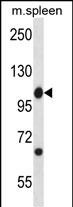 Mouse Abl1 Antibody (Center) (Cat. #AP13907c) western blot analysis in mouse spleen tissue lysates (35ug/lane).This demonstrates the Abl1 antibody detected the Abl1 protein (arrow).