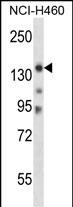 WB - Mouse Myo3b Antibody (N-term) AP13924a