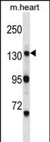 WB - Mouse Myo3b Antibody (N-term) AP13924a