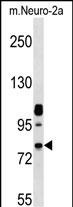 WB - Mouse Nek8 Antibody (C-term) AP13927B