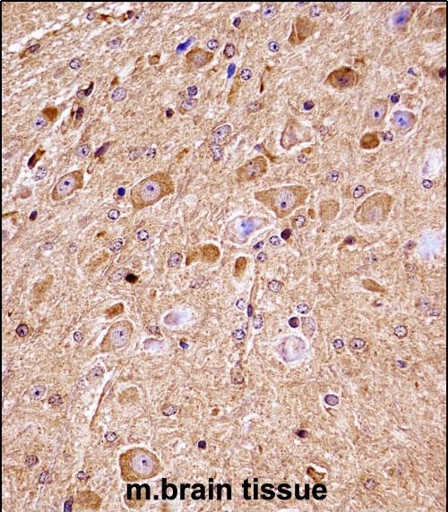 IHC-P - Mouse Nlk Antibody (C-term) AP13929b