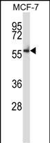 WB - Mouse Nlk Antibody (C-term) AP13929b