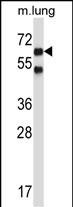 WB - Mouse Nlk Antibody (C-term) AP13929b