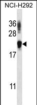 WB - TTC33 Antibody AP15007a