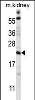 WB - TTC33 Antibody AP15007a