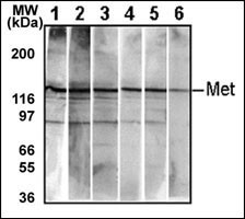 Detection of endogenous Met in HepG2 cell line. 10 μg/lane of HepG2 cell lysate was used to examine the expression of human Met. Lanes 1-5 represent Abgent's different anti-Met monoclonal antibodies that are Cat# AM1001-1005. Lane 6 represents auto-phosohorylated-Met in HepG2 cell line detected by anti-phospho-Met Mab (Cat# AM1000).