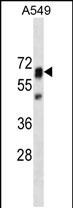 PTPN11 Antibody (Cat. #AM1920b) western blot analysis in A549 cell line lysates (35?g/lane).This demonstrates the PTPN11 antibody detected the PTPN11 protein (arrow).