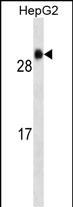 GSTA1 Antibody (Cat. #AM1932b) western blot analysis in HepG2 cell line lysates (35?g/lane).This demonstrates the GSTA1 antibody detected the GSTA1 protein (arrow).