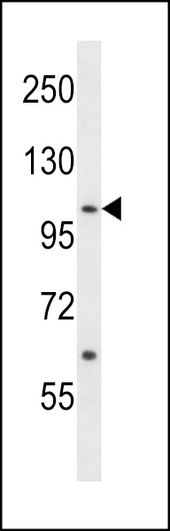 ACK1 Antibody (Center Y284) (Cat. #AP13936c) western blot analysis in NCI-H460 cell line lysates (35ug/lane).This demonstrates the ACK1 antibody detected the ACK1 protein (arrow).