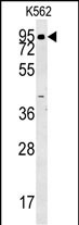 ABP1 Antibody (N-term) (Cat. #AP13940a) western blot analysis in K562 cell line lysates (35ug/lane).This demonstrates the ABP1 antibody detected the ABP1 protein (arrow).