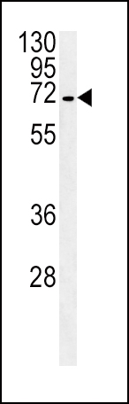 SLC22A1 Antibody (C-term) (Cat. #AP13944b) western blot analysis in HepG2 cell line lysates (35ug/lane).This demonstrates the SLC22A1 antibody detected the SLC22A1 protein (arrow).