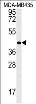 WB - VASH2 Antibody (C-term) AP13956b