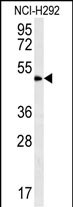 WB - ZNF154 Antibody (N-term) AP13959a