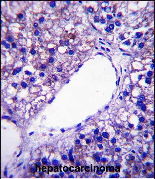 IHC-P - PNPLA4 Antibody (C-term) AP13971b