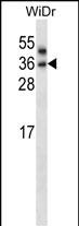 WB - PNPLA4 Antibody (C-term) AP13971b