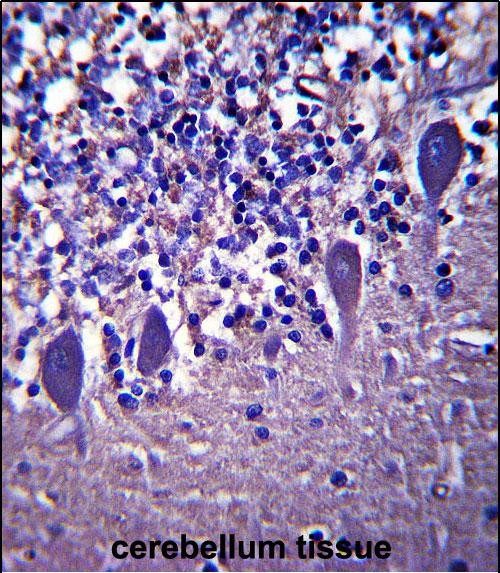 IHC-P - LRRC8B Antibody (N-term ) AP13978a