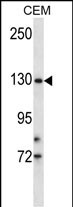 WB - TMPRSS9 Antibody (N-term) AP14011a