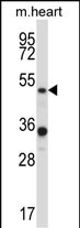 PIAS4 Antibody (N-term) (Cat. #AP14013a) western blot analysis in mouse heart tissue lysates (35ug/lane).This demonstrates the PIAS4 antibody detected the PIAS4 protein (arrow).